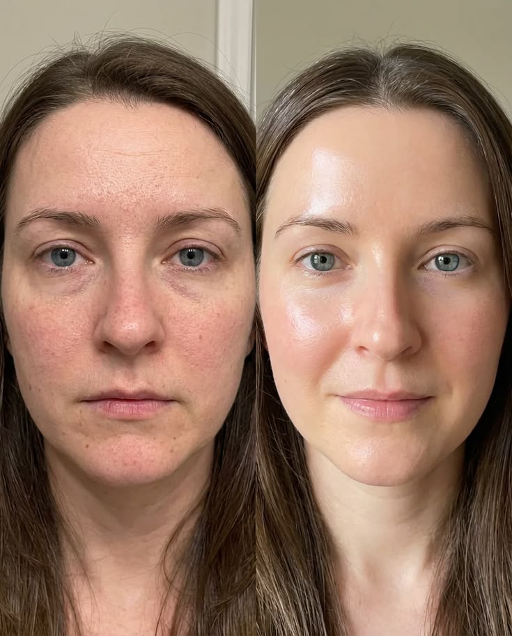 Side-by-side comparison of a woman’s face before and after using the GlowLift Ice Facial Massager: left shows redness and dullness, right displays smoother, clearer skin with less puffiness and a healthy glow.